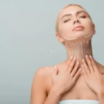 Neck Lift: Solutions for Turkey Neck and Double Chin