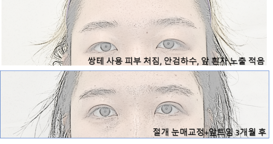 그림3