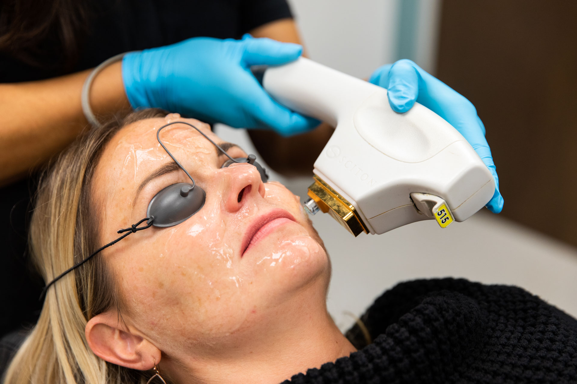 skin-tightening-skintyte
