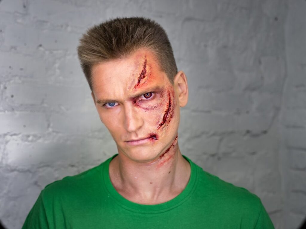 facelift scar