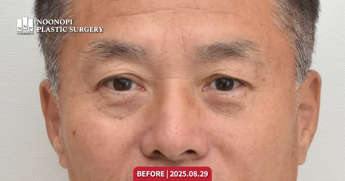 typical aging appearance of 50s