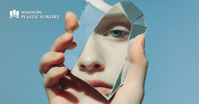 검은자가 노출되는 크기로 짝눈을 판단한다