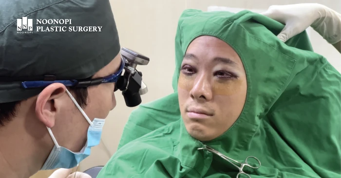 Checking left-right eye size during ptosis surgery