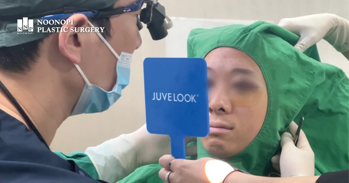 짝눈 교정을 하면서 수술 중 눈 대칭을 확인 하는 모습