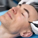 3 Tips About Bald Mens Facelifts You Didn’t Know