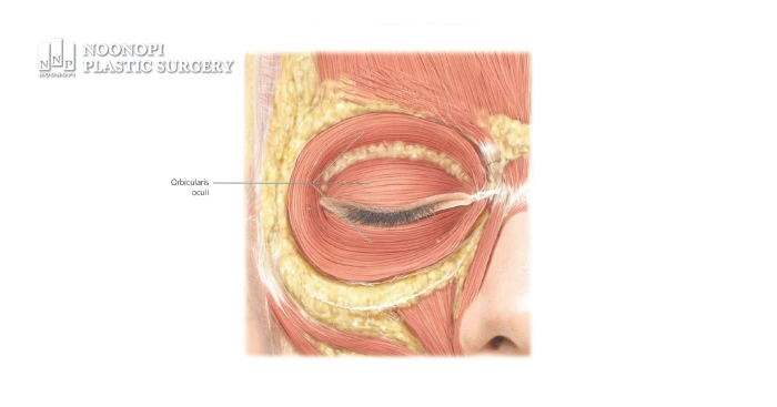 Aegyosal is created by the contraction of the orbicularis oculi muscle around the eyes
