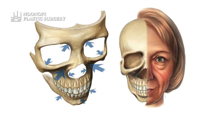 나이에 따른 얼굴 골격 변화 과정